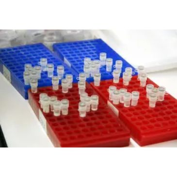 Can Law Enforcement Officers Take Your DNA When You are Booked on Criminal Charges?