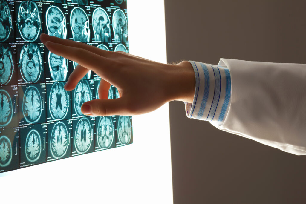 What Is a Personal Injury Case in Colorado?